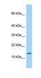 LOC100359563 antibody, orb326080, Biorbyt, Western Blot image 