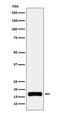 ISG15 Ubiquitin Like Modifier antibody, M00554-2, Boster Biological Technology, Western Blot image 