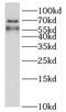 Histamine Receptor H2 antibody, FNab04011, FineTest, Western Blot image 