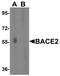 Beta-Secretase 2 antibody, NBP1-77308, Novus Biologicals, Western Blot image 