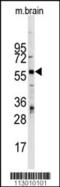 Zinc finger and BTB domain-containing protein 7B antibody, 62-265, ProSci, Western Blot image 