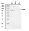 ADAM Metallopeptidase Domain 8 antibody, A04306-4, Boster Biological Technology, Western Blot image 