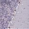 Chromosome 2 Open Reading Frame 49 antibody, NBP2-14404, Novus Biologicals, Immunohistochemistry paraffin image 