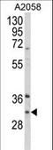 Inhibitor Of Growth Family Member 5 antibody, LS-C165238, Lifespan Biosciences, Western Blot image 