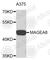 MAGE Family Member A8 antibody, A3951, ABclonal Technology, Western Blot image 