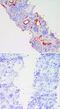 Selectin E antibody, BBA18, R&D Systems, Immunohistochemistry frozen image 