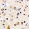 Crystallin Alpha B antibody, LS-C358953, Lifespan Biosciences, Immunohistochemistry paraffin image 