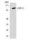 Ubiquitin Specific Peptidase 13 antibody, LS-C200806, Lifespan Biosciences, Western Blot image 