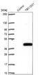 TBC1 Domain Family Member 21 antibody, NBP1-92479, Novus Biologicals, Western Blot image 