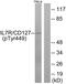 Interleukin 7 Receptor antibody, PA5-38619, Invitrogen Antibodies, Western Blot image 