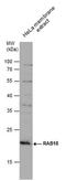 RAB18, Member RAS Oncogene Family antibody, PA5-78429, Invitrogen Antibodies, Western Blot image 