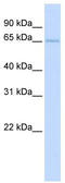 Transketolase Like 2 antibody, TA346849, Origene, Western Blot image 