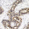 p21Cip1 antibody, TA333181, Origene, Immunohistochemistry paraffin image 