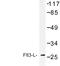 Fms Related Tyrosine Kinase 3 Ligand antibody, LS-C176911, Lifespan Biosciences, Western Blot image 