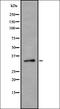 Proteasome 26S Subunit, Non-ATPase 14 antibody, orb336978, Biorbyt, Western Blot image 