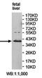 Alpha-1,4-N-Acetylglucosaminyltransferase antibody, orb78237, Biorbyt, Western Blot image 