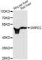 Sphingomyelin Phosphodiesterase 2 antibody, A1166, ABclonal Technology, Western Blot image 