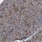 Zinc Finger Protein 343 antibody, HPA030587, Atlas Antibodies, Immunohistochemistry paraffin image 