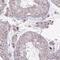 Zinc Finger And SCAN Domain Containing 9 antibody, NBP2-31579, Novus Biologicals, Immunohistochemistry paraffin image 