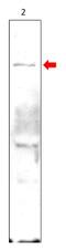 Phosphodiesterase 10A antibody, GTX30756, GeneTex, Western Blot image 