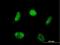 LIM Homeobox 4 antibody, H00089884-M03, Novus Biologicals, Immunofluorescence image 