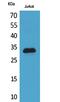 Cyclin Dependent Kinase Inhibitor 1C antibody, A01244, Boster Biological Technology, Western Blot image 