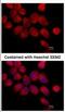 Transketolase antibody, NBP2-20699, Novus Biologicals, Immunocytochemistry image 