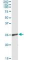 RING finger protein 114 antibody, H00055905-M03, Novus Biologicals, Immunoprecipitation image 