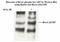 BRCA1 DNA Repair Associated antibody, NB100-225, Novus Biologicals, Western Blot image 