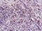 TNF Receptor Superfamily Member 10a antibody, 251233, Abbiotec, Immunohistochemistry paraffin image 