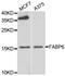 Fatty Acid Binding Protein 6 antibody, abx005249, Abbexa, Western Blot image 