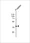 CD40 Molecule antibody, LS-C159311, Lifespan Biosciences, Western Blot image 