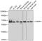 Carnosine Dipeptidase 1 antibody, GTX33103, GeneTex, Western Blot image 