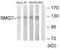 SMG7 Nonsense Mediated MRNA Decay Factor antibody, abx013730, Abbexa, Western Blot image 