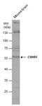 Corticotropin Releasing Hormone Receptor 1 antibody, GTX130244, GeneTex, Western Blot image 