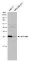 Cyclin Dependent Kinase Inhibitor 1B antibody, GTX100446, GeneTex, Western Blot image 