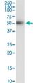 Desert Hedgehog Signaling Molecule antibody, H00050846-M03, Novus Biologicals, Western Blot image 