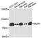 Nexilin F-Actin Binding Protein antibody, A13136, ABclonal Technology, Western Blot image 