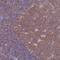 Nicotinamide Phosphoribosyltransferase antibody, HPA047776, Atlas Antibodies, Immunohistochemistry paraffin image 