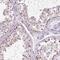 Chondrolectin antibody, NBP1-86817, Novus Biologicals, Immunohistochemistry paraffin image 