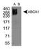 ATP Binding Cassette Subfamily A Member 1 antibody, NB400-164, Novus Biologicals, Western Blot image 