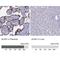 AceCS2 antibody, NBP2-30612, Novus Biologicals, Immunohistochemistry paraffin image 