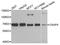 Cytoskeleton Associated Protein 4 antibody, A7777, ABclonal Technology, Western Blot image 