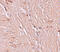 Zinc finger and BTB domain-containing protein 4 antibody, 6121, ProSci, Immunohistochemistry paraffin image 