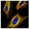 Voltage Dependent Anion Channel 2 antibody, NBP2-20849, Novus Biologicals, Immunofluorescence image 