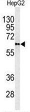 Phospholipid Transfer Protein antibody, GTX81352, GeneTex, Western Blot image 