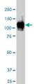 ATPase Sarcoplasmic/Endoplasmic Reticulum Ca2+ Transporting 1 antibody, H00000487-M01, Novus Biologicals, Western Blot image 