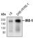 Insulin Receptor Substrate 1 antibody, MA5-15072, Invitrogen Antibodies, Western Blot image 