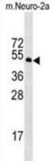 Serine/Threonine Kinase 39 antibody, abx029443, Abbexa, Western Blot image 