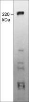 Transient Receptor Potential Cation Channel Subfamily M Member 7 antibody, TM5731, ECM Biosciences, Western Blot image 